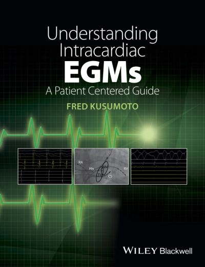 Cover for Kusumoto, Fred M. (Mayo Clinic, Jacksonville, Florida) · Understanding Intracardiac EGMs: A Patient Centered Guide (Paperback Book) (2015)