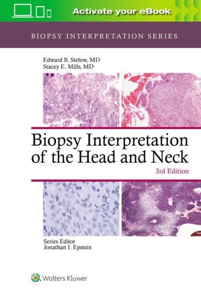Cover for Edward B. Stelow · Biopsy Interpretation of the Head and Neck - Biopsy Interpretation Series (Hardcover bog) (2020)