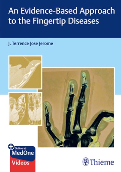 An Evidence-Based Approach to the Fingertip Diseases -  - Inne - Thieme Publishers Delhi - 9789392819360 - 14 października 2024