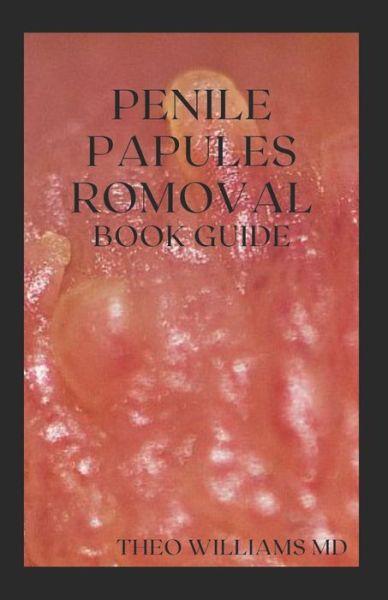 Cover for Theo Williams · Penile Papules Romoval Book Guide (Taschenbuch) (2021)