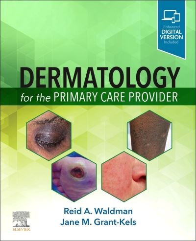 Dermatology for the Primary Care Provider - Waldman, Reid A., MD - Böcker - Elsevier - Health Sciences Division - 9780323712361 - 27 augusti 2021