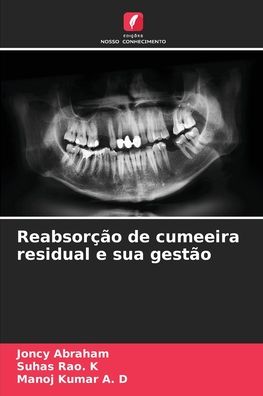 Cover for Joncy Abraham · Reabsorcao de cumeeira residual e sua gestao (Paperback Book) (2021)