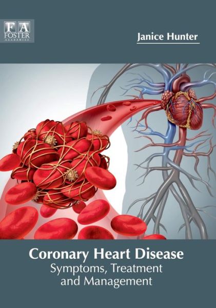 Coronary Heart Disease: Symptoms, Treatment and Management - Janice Hunter - Books - Foster Academics - 9781632425362 - May 28, 2018