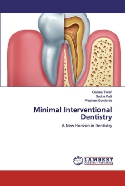 Cover for Tiwari · Minimal Interventional Dentistry (Bog) (2019)