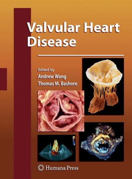 Cover for Andrew Wang · Valvular Heart Disease - Contemporary Cardiology (Paperback Book) [2009 edition] (2012)