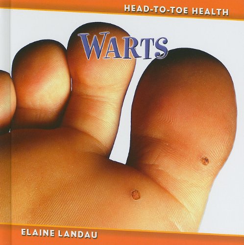 Cover for Elaine Landau · Warts (Head-to-toe Health) (Hardcover Book) (2011)