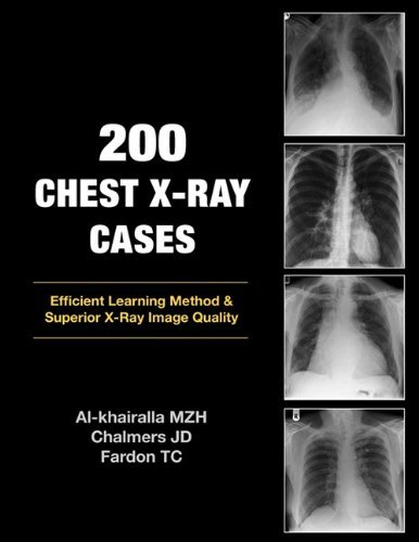 Cover for Tom Fardon · 200 Chest X-ray Cases (Taschenbuch) (2009)