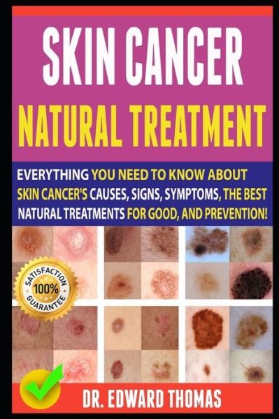 Cover for Edward Thomas · Skin Cancer Natural Treatment (Paperback Book) (2019)