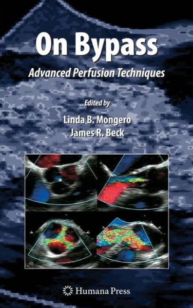 Cover for Linda B Mongero · On Bypass: Advanced Perfusion Techniques - Current Cardiac Surgery (Hardcover Book) [2008 edition] (2008)