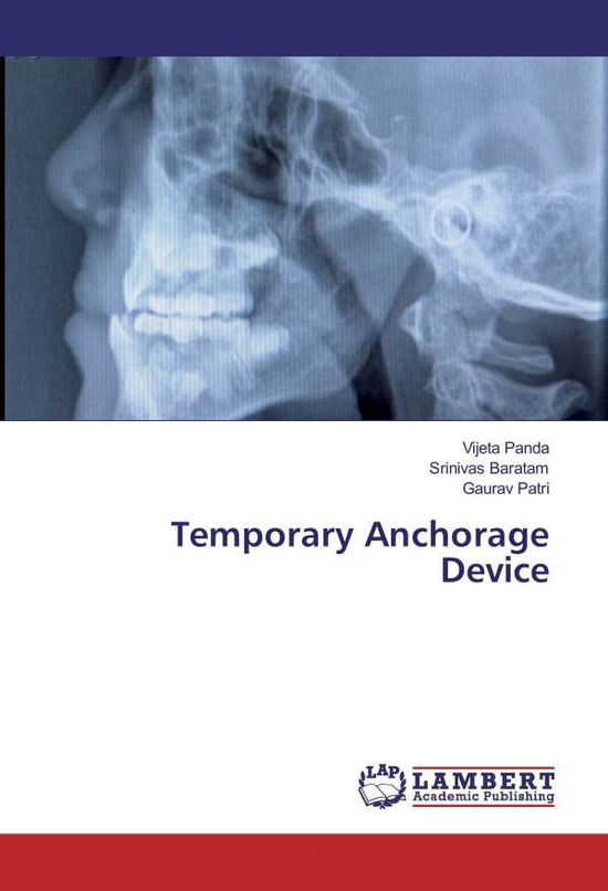 Cover for Panda · Temporary Anchorage Device (Bog)