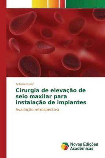 Cover for Diniz Antoniel · Cirurgia De Elevacao De Seio Maxilar Para Instalacao De Implantes (Paperback Book) (2015)