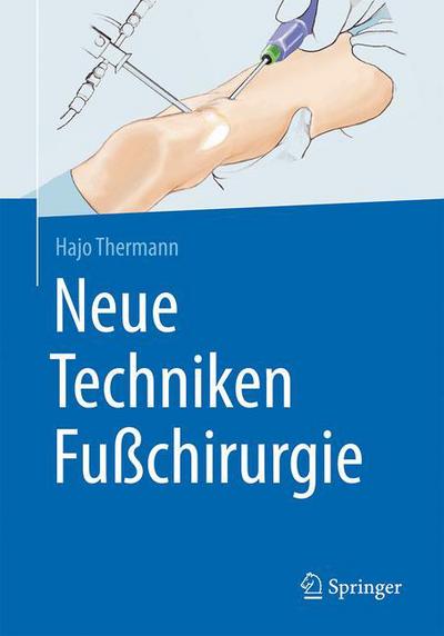 Cover for Hajo Thermann · Neue Techniken Fuchirurgie (Hardcover Book) (2016)