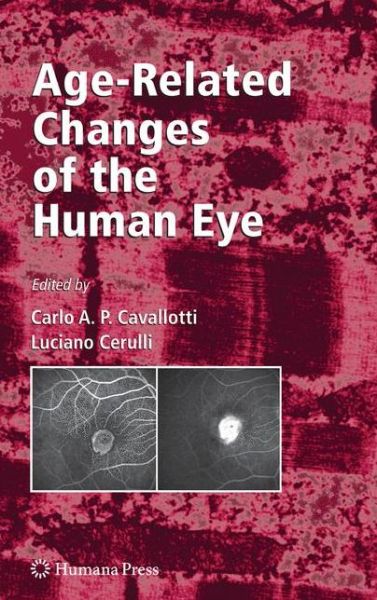 Cover for Carlo Cavallotti · Age-Related Changes of the Human Eye - Aging Medicine (Paperback Book) [Softcover reprint of hardcover 1st ed. 2008 edition] (2010)