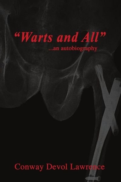 Cover for Conway Devol Lawrence · Warts And All (Paperback Bog) (2019)