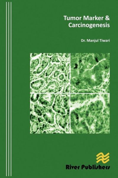 Cover for Manjul Tiwari · Tumor Marker and Carcinogenesis (Hardcover Book) (2012)