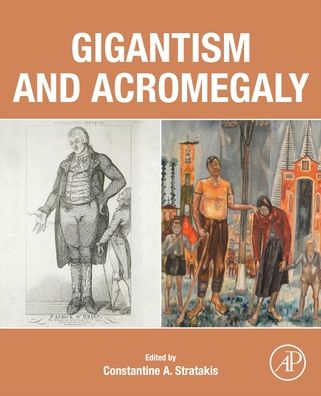 Gigantism and Acromegaly - - Livros - Elsevier Science Publishing Co Inc - 9780128145371 - 9 de junho de 2021