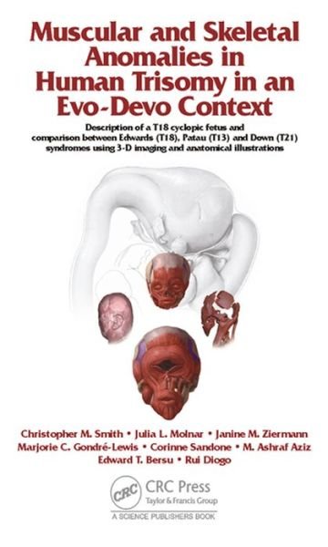 Cover for Rui Diogo · Muscular and Skeletal Anomalies in Human Trisomy in an Evo-Devo Context: Description of a T18 Cyclopic Fetus and Comparison Between Edwards (T18), Patau (T13) and Down (T21) Syndromes Using 3-D Imaging and Anatomical Illustrations (Hardcover Book) (2015)