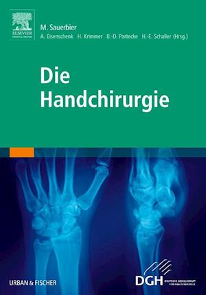 Cover for Andreas Eisenschenk · Die Handchirurgie (Hardcover Book) (2021)