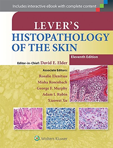 Levers Histopathology Of The Skin 11E Cb - Elder - Książki - Lippincott Williams and Wilkins - 9781451190373 - 30 października 2014