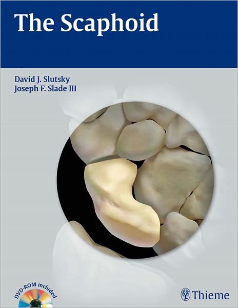 The Scaphoid - David J. Slutsky - Libros - Thieme Medical Publishers Inc - 9781604062373 - 8 de octubre de 2010
