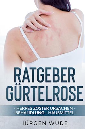 Cover for Jürgen Wude · Ratgeber Gürtelrose (Book) (2023)