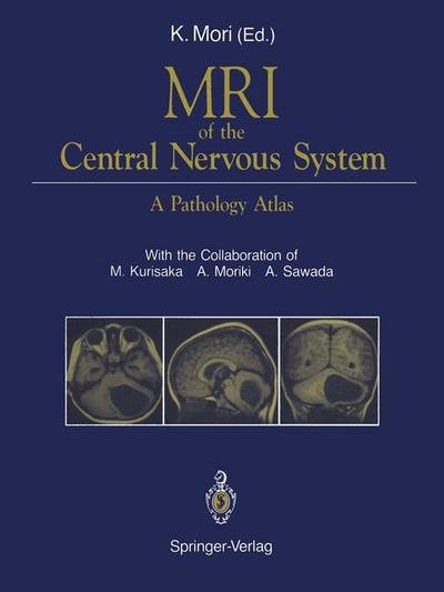 A Sawada · MRI of the Central Nervous System: A Pathology Atlas (Taschenbuch) [Softcover reprint of the original 1st ed. 1991 edition] (2011)