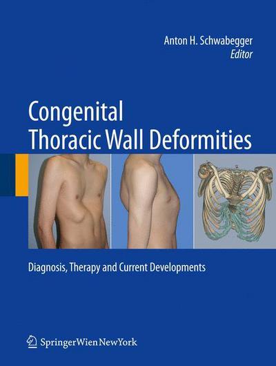 Cover for Anton H Schwabegger · Congenital Thoracic Wall Deformities: Diagnosis, Therapy and Current Developments (Hardcover Book) (2011)