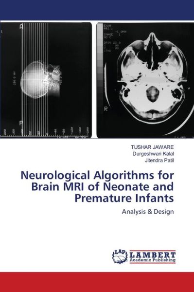 Neurological Algorithms for Brai - Jaware - Książki -  - 9786202512374 - 13 marca 2020