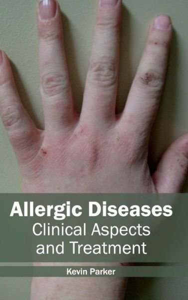 Cover for Kevin Parker · Allergic Diseases: Clinical Aspects and Treatment (Gebundenes Buch) (2015)