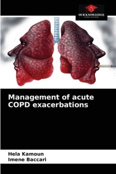 Cover for Hela Kamoun · Management of acute COPD exacerbations (Paperback Book) (2021)