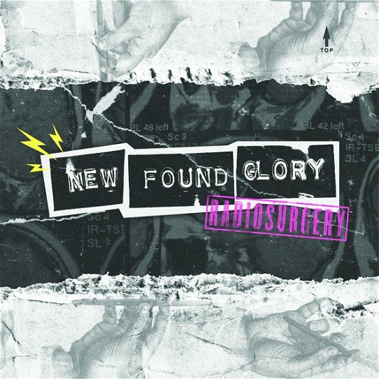 Cover for New Found Glory · Radiosurgery (COLOR VINYL) (7&quot;) [Coloured edition] (2011)