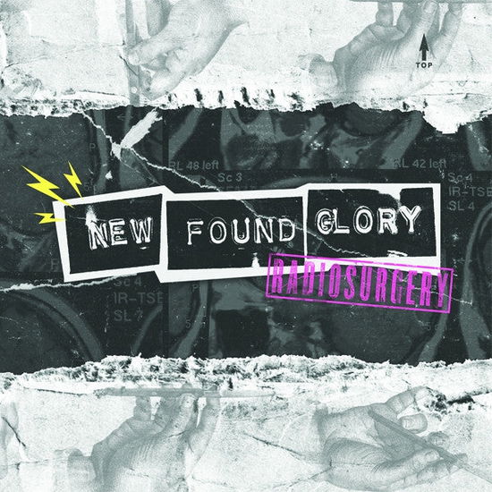 Cover for New Found Glory · Radiosurgery (COLOR VINYL) (7&quot;) [Coloured edition] (2011)