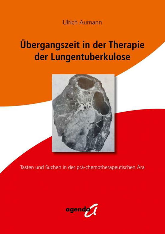 Cover for Aumann · Übergangszeit in der Therapie de (Book)