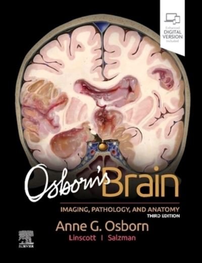 Cover for Osborn, Anne G., MD, FACR (University Distinguished Professor and Professor of Radiology and Imaging Sciences, William H. and Patricia W. Child Presidential Endowed Chair in Radiology, University of Utah School of Medicine, Salt Lake City, Utah) · Osborn's Brain (Hardcover Book) (2023)