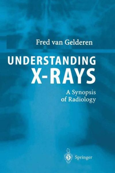 Understanding X-Rays: A Synopsis of Radiology - Fred Van Gelderen - Books - Springer-Verlag Berlin and Heidelberg Gm - 9783540001379 - December 3, 2003