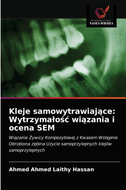 Cover for Ahmed Ahmed Laithy Hassan · Kleje samowytrawiaj?ce (Paperback Book) (2021)