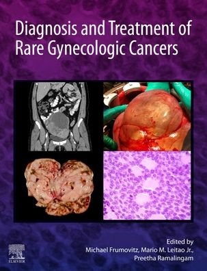 Cover for Frumovitz, Michael (Professor, Gynecologic Oncology, MD Anderson Cancer Center) · Diagnosis and Treatment of Rare Gynecologic Cancers (Gebundenes Buch) (2022)