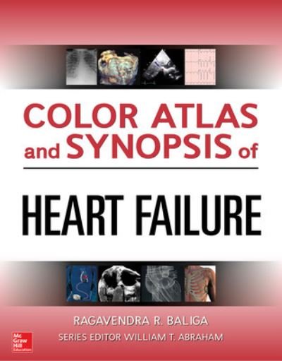 Cover for Ragavendra Baliga · Color Atlas and Synopsis of Heart Failure (Hardcover bog) [Ed edition] (2019)