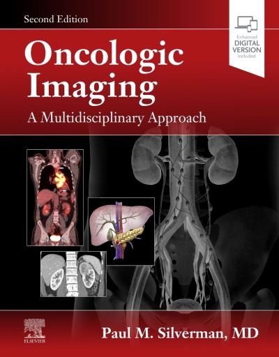 Cover for Silverman · Oncologic Imaging: A Multidisciplinary Approach (Hardcover Book) (2022)