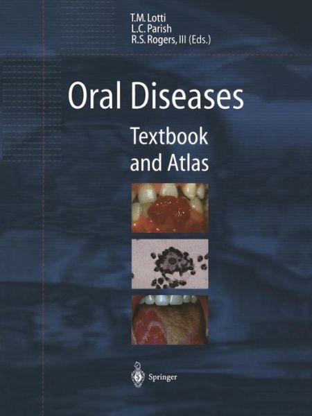 Cover for Torello M Lotti · Oral Diseases: Textbook and Atlas (Paperback Book) [Softcover reprint of the original 1st ed. 1999 edition] (2011)