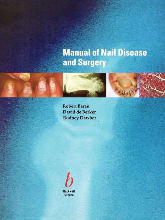 Cover for Robert Baran · Manual of Nail Disease and Surgery (Paperback Book) (1997)