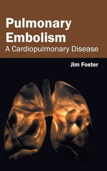 Cover for Jim Foster · Pulmonary Embolism: a Cardiopulmonary Disease (Gebundenes Buch) (2015)