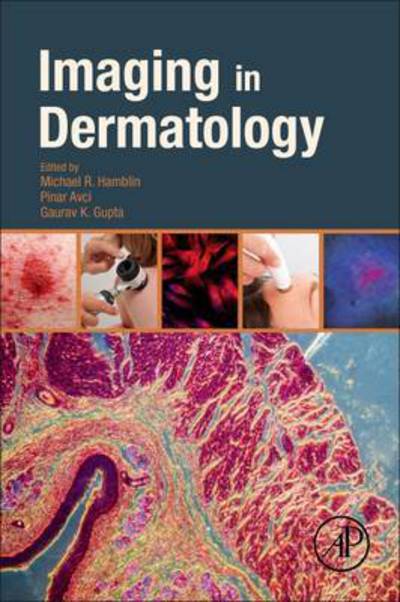 Imaging in Dermatology - Michael Hamblin - Books - Elsevier Science Publishing Co Inc - 9780128028384 - August 11, 2016