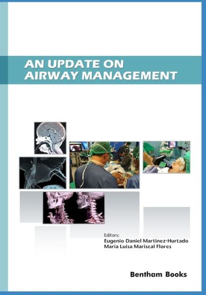 An Update on Airway Management - Eugenio Daniel Martinez Hurtado - Books - Bentham Science Publishers - 9789811432385 - February 20, 2020