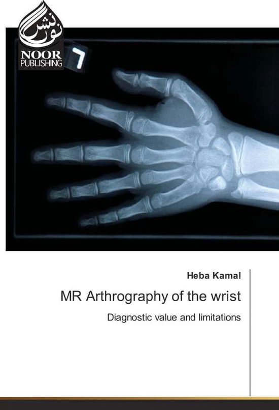 Cover for Kamal · MR Arthrography of the wrist (Book)