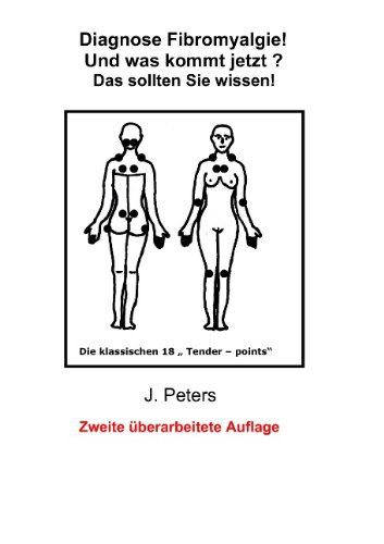 Cover for Joachim Peters · Diagnose Fibromyalgie! Und Was Kommt Jetzt? (Paperback Book) [German edition] (2009)