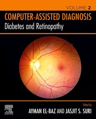 Cover for Ayman S El-Baz · Diabetes and Retinopathy - Computer-Assisted Diagnosis (Paperback Book) (2020)