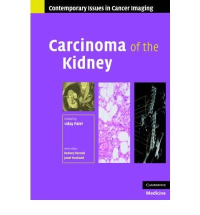 Cover for Uday Patel · Carcinoma of the Kidney - Contemporary Issues in Cancer Imaging (Hardcover bog) (2007)