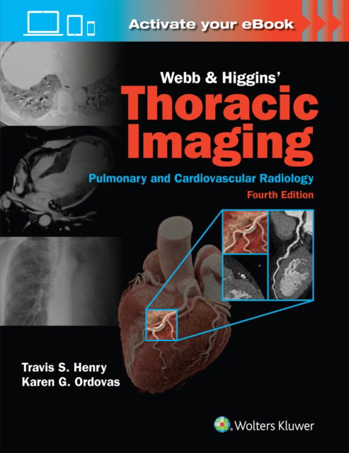 Travis Henry · Webb & Higgins Thoracic Imaging: Print + eBook with Multimedia (Hardcover Book) (2024)