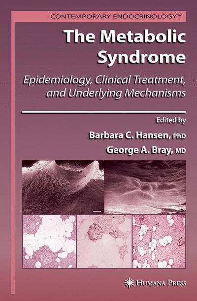 Cover for Barbara C Hansen · The Metabolic Syndrome:: Epidemiology, Clinical Treatment, and Underlying Mechanisms - Contemporary Endocrinology (Hardcover Book) [2008 edition] (2008)